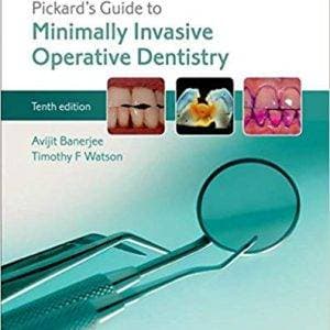 Pickard's Guide to Minimally Invasive Operative Dentistry (10th Edition) - eBook