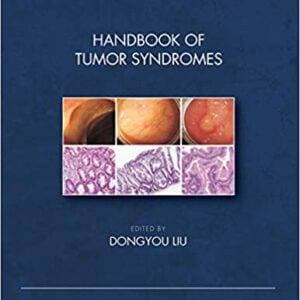 Handbook of Tumor Syndromes - eBook