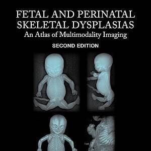 Fetal and Perinatal Skeletal Dysplasias An Atlas of Multimodality Imaging (2nd Edition) - eBook