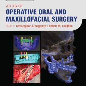 Atlas of Operative Oral and Maxillofacial Surgery (2nd Edition) - eBook