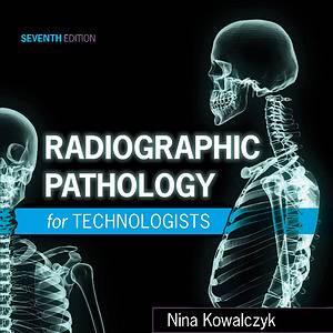 Radiographic Pathology for Technologists (7th Edition) - eBook